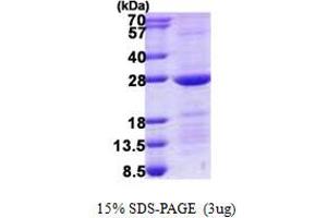 RAB10 Protein (His tag)