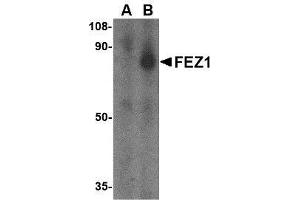 Western blot analysis of FEZ1 in SK-N-SH cell lysate with AP30333PU-N FEZ1 antibody at 1 μg/ml in the (A) presence and (B) absence of blocking peptide. (FEZ1 抗体  (C-Term))
