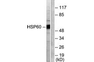 Western blot analysis of extracts from COLO205 cells, using HSP60 Antibody. (HSPD1 抗体  (AA 511-560))