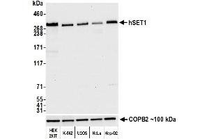 Western Blotting (WB) image for anti-hSET1 (AA 1200-1250) antibody (ABIN7454027)