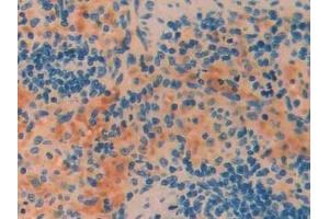 Detection of CRF in Rat Spleen Tissue using Polyclonal Antibody to Corticotropin Releasing Factor (CRF) (CRH 抗体  (AA 39-187))
