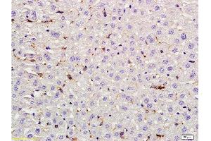 Formalin-fixed and paraffin embedded rat liver labeled with Rabbit Anti LIF Polyclonal Antibody, Unconjugated  at 1:200 followed by conjugation to the secondary antibody and DAB staining (LIF 抗体  (AA 101-202))