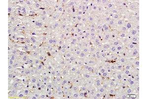 Formalin-fixed and paraffin embedded rat liver labeled with Rabbit Anti LIF Polyclonal Antibody, Unconjugated  at 1:200 followed by conjugation to the secondary antibody and DAB staining (LIF 抗体  (AA 101-202))