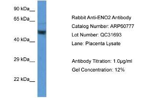 Western Blotting (WB) image for anti-Enolase 2 (Gamma, Neuronal) (ENO2) (Middle Region) antibody (ABIN2788574) (ENO2/NSE 抗体  (Middle Region))