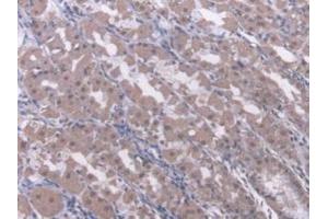Detection of RARb in Human Stomach Tissue using Polyclonal Antibody to Retinoic Acid Receptor Beta (RARb) (Retinoic Acid Receptor beta 抗体  (AA 205-451))