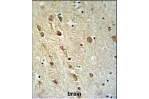 Immunohistochemistry (Paraffin-embedded Sections) (IHC (p)) image for anti-Zinc Finger, RAN-Binding Domain Containing 1 (ZRANB1) (AA 665-692), (C-Term) antibody (ABIN653787)