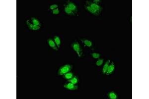 Immunofluorescent analysis of HepG2 cells using ABIN7149283 at dilution of 1:100 and Alexa Fluor 488-congugated AffiniPure Goat Anti-Rabbit IgG(H+L) (CYGB 抗体  (AA 1-190))