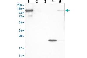 Western blot analysis of Lane 1: RT-4, Lane 2: U-251 MG, Lane 3: Human Plasma, Lane 4: Liver, Lane 5: Tonsil with FAM35A polyclonal antibody  at 1:100-1:250 dilution. (FAM35A 抗体)
