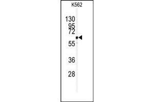 Image no. 1 for anti-Ubiquitin Specific Peptidase 3 (USP3) (C-Term) antibody (ABIN357524) (USP3 抗体  (C-Term))