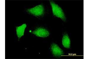 Immunofluorescence of purified MaxPab antibody to PPM1F on HeLa cell. (PPM1F 抗体  (AA 1-454))