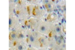 IHC-P analysis of Liver tissue, with DAB staining. (TNFRSF11A 抗体  (AA 359-542))