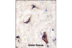 Formalin-fixed and paraffin-embedded human brain tissue reacted with RASGRF1 Antibody  (ABIN391841 and ABIN2841679) , which was peroxidase-conjugated to the secondary antibody, followed by DAB staining. (RASGRF1 抗体  (AA 907-936))