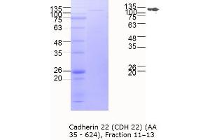 Western Blotting (WB) image for Cadherin-Like 22 (CDH22) (AA 35-624) protein (MBP tag) (ABIN3118965) (CDH22 Protein (AA 35-624) (MBP tag))
