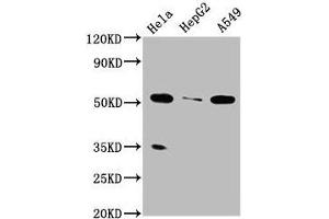 Western Blot Positive WB detected in: Hela whole cell lysate, HepG2 whole cell lysate, A549 whole cell lysate All lanes: MSS51 antibody at 4 μg/mL Secondary Goat polyclonal to rabbit IgG at 1/50000 dilution Predicted band size: 52, 27, 11 kDa Observed band size: 52 kDa (ZMYND17 抗体  (AA 258-365))