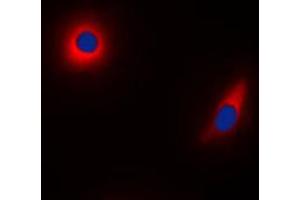 Immunofluorescence (IF) image for anti-NADH Dehydrogenase (Ubiquinone) Fe-S Protein 1, 75kDa (NADH-Coenzyme Q Reductase) (NDUFS1) (C-Term) antibody (ABIN7296398)