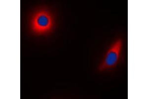 Immunofluorescent analysis of NDUFS1 staining in HeLa cells. (NDUFS1 抗体  (C-Term))