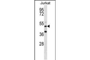 Western blot analysis in Jurkat cell line lysates (35ug/lane). (RBM22 抗体  (AA 165-193))
