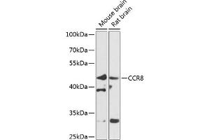 Western blot analysis of extracts of various cell lines, using CCR8 antibody (ABIN6130010, ABIN6138101, ABIN6138102 and ABIN6224067) at 1:1000 dilution. (CCR8 抗体  (AA 296-355))