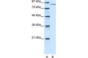 Western Blotting (WB) image for anti-Lysine (K)-Specific Demethylase 2A (KDM2A) antibody (ABIN2460277) (KDM2A 抗体)