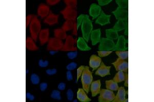 ABIN7096942 and ABIN7101008 staining Hela cells(30 min of UV treatment) by IF/ICC. (C22orf9 抗体)