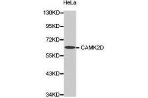 Western Blotting (WB) image for anti-Calcium/calmodulin-Dependent Protein Kinase II delta (CAMK2D) antibody (ABIN1871415) (CAMK2D 抗体)