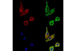 anti-Cystatin SA (CST2) (N-Term) antibody