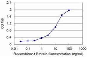 Detection limit for recombinant GST tagged IL1B is approximately 0. (IL-1 beta 抗体  (AA 170-269))