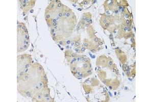 Immunohistochemistry of paraffin-embedded Human stomach using RPLP1 Polyclonal Antibody at dilution of 1:100 (40x lens). (RPLP1 抗体)