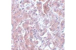 Immunohistochemical staining of human liver tissue with ELOVL7 polyclonal antibody  at 5 ug/mL dilution. (ELOVL7 抗体  (N-Term))