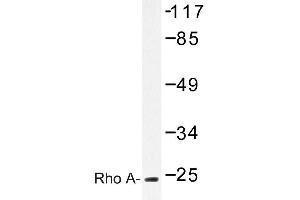 Image no. 1 for anti-Ras Homolog Gene Family, Member A (RHOA) antibody (ABIN272117) (RHOA 抗体)