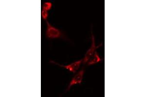 ABIN6274151 staining Hela cells by IF/ICC. (CKM 抗体  (N-Term))