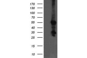 Image no. 3 for anti-Chaperonin Containing TCP1, Subunit 8 (Theta)-Like 2 (CCT8L2) antibody (ABIN1497480)