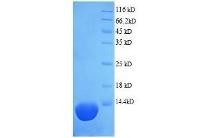 SDS-PAGE (SDS) image for Complement Component 5 (C5) (AA 1-74), (full length) protein (His tag) (ABIN7478993)