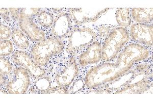 Immunohistochemistry (IHC) image for anti-Arginase, Type II (ARG2) (AA 23-354) antibody (ABIN7426919)