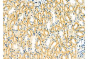 ABIN6261431 and ABIN6279416 at 1/100 staining Rat kidney tissue by IHC-P. (EDEM3 抗体  (C-Term))