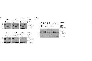 Western Blotting (WB) image for anti-Collagen, Type I (COL1) antibody (ABIN135046)