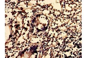 IHC image of ABIN7163135 diluted at 1:600 and staining in paraffin-embedded human appendix tissue performed on a Leica BondTM system. (Sphingomyelin Synthase 2 抗体  (AA 1-79))