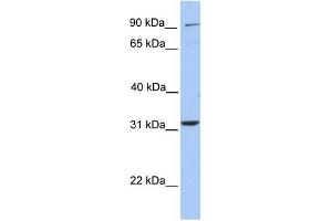 ELFN2 antibody used at 1 ug/ml to detect target protein. (ELFN2 抗体  (N-Term))