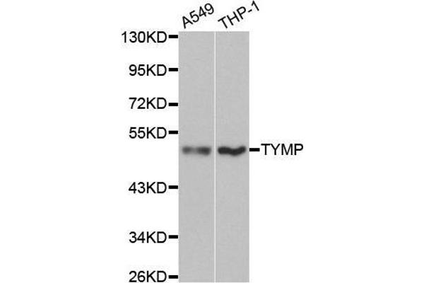 Thymidine Phosphorylase 抗体  (AA 1-200)