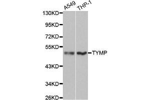 Western blot analysis of extracts of various cell lines, using TYMP antibody.