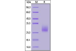 Biotinylated Mouse CTLA-4, His,Avitag on  under reducing (R) condition. (CTLA4 Protein (AA 36-162) (His tag,AVI tag,Biotin))