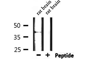 Western blot analysis of extracts from rat brain, using MT-CYB Antibody. (Cytochrome b 抗体  (N-Term))