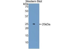 Western blot analysis of the recombinant protein. (Androgen Receptor 抗体  (AA 491-679))