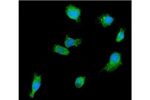 IF analysis of DDX6 using anti-DDX6 antibody (ABIN7602043).