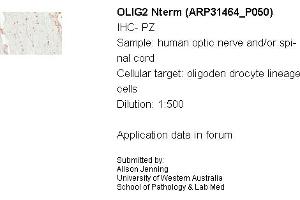 Sample Type: Human Optic Nerve and Spinal CordCellular Target: Oligoden Drocyte Lineage CellsDilution: 1:500 (OLIG2 抗体  (N-Term))