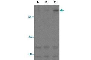 Western blot analysis of ANTXR1 in K-562 cell lysates with ANTXR1 polyclonal antibody  at (A) 0. (ANTXR1 抗体)