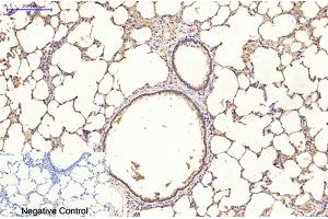 anti-Ubiquitin (Ub) antibody
