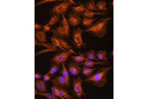 Immunofluorescence analysis of C6 cells using Apolipoprotein  Rabbit pAb (ABIN7265634) at dilution of 1:100. (APOA2 抗体  (AA 1-100))