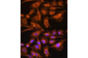 Immunofluorescence analysis of C6 cells using Apolipoprotein  Rabbit pAb (ABIN7265634) at dilution of 1:100. (APOA2 抗体  (AA 1-100))