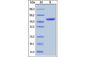 SDS-PAGE (SDS) image for Poliovirus Receptor-Related Immunoglobulin Domain Containing (PVRIG) (AA 35-165) protein (Fc Tag) (ABIN6809881)